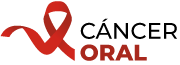 Cáncer Oral Cáncer Oral